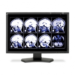 Monitor NEC para la Visualización de Imágenes de Diagnóstico MD242C2 LCD 24”, HDMI, Negro 